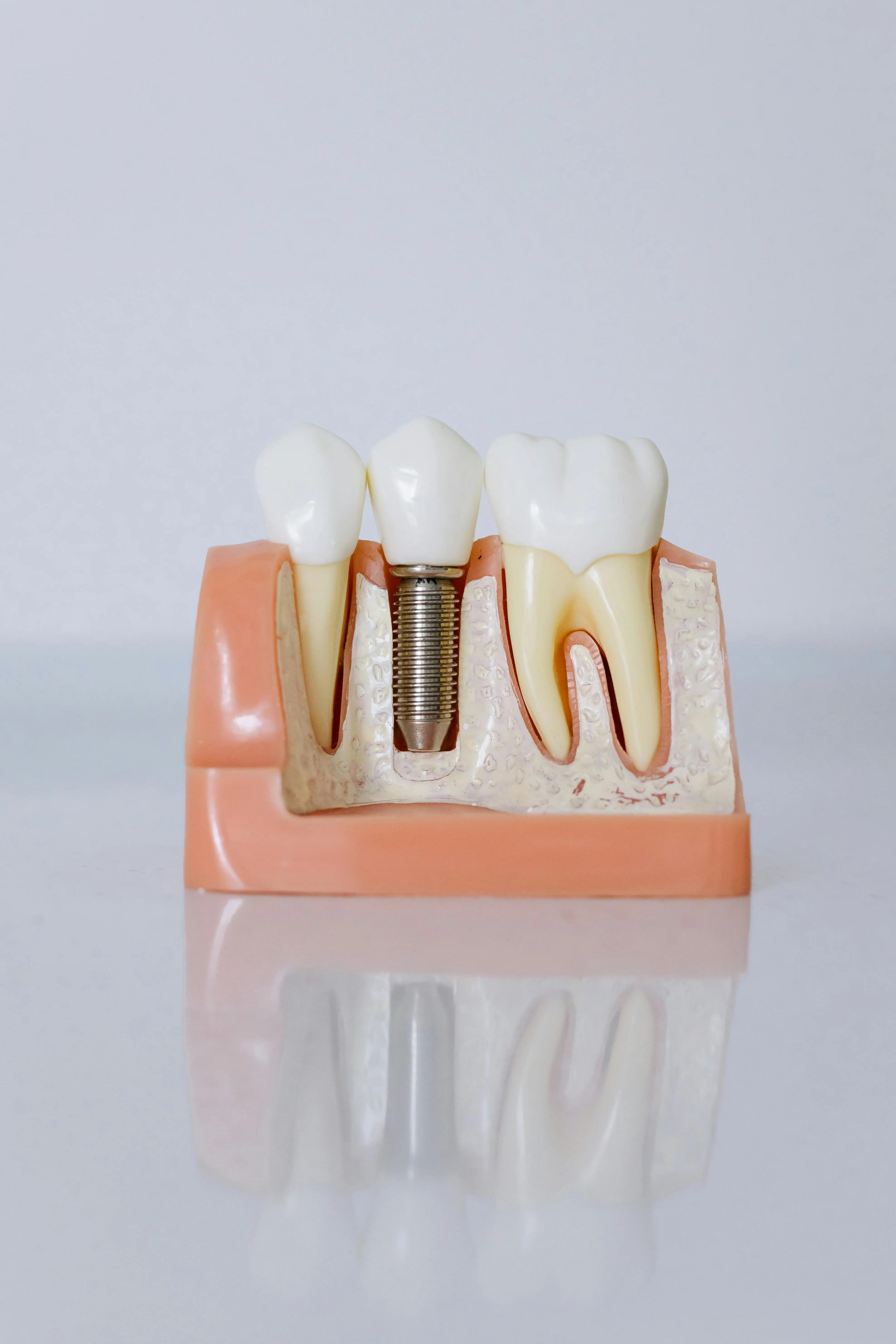 Oral Surgery